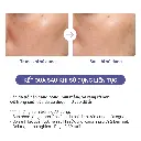 EC-Attenir-M15013-6.webp